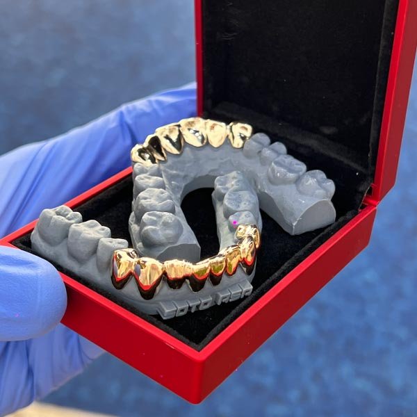 doble joyas dentales marllorca