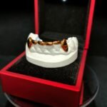 joyeria dental mallorca oro