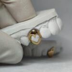 grillz dental mallorca