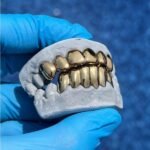 joyeria de oro en dientes